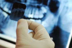 Digital Extraoral X-Rays are am important technology we use to help the residents of Kenosha and Paddock Lake.